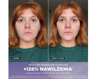 Shark Hydroaktywny system pielęgnacji twarzy FacialPro Glow FH320E - 1568664 - zdjęcie 5